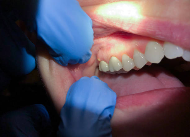 Best Tooth Infection Emergency Dentist  in Altus, OK